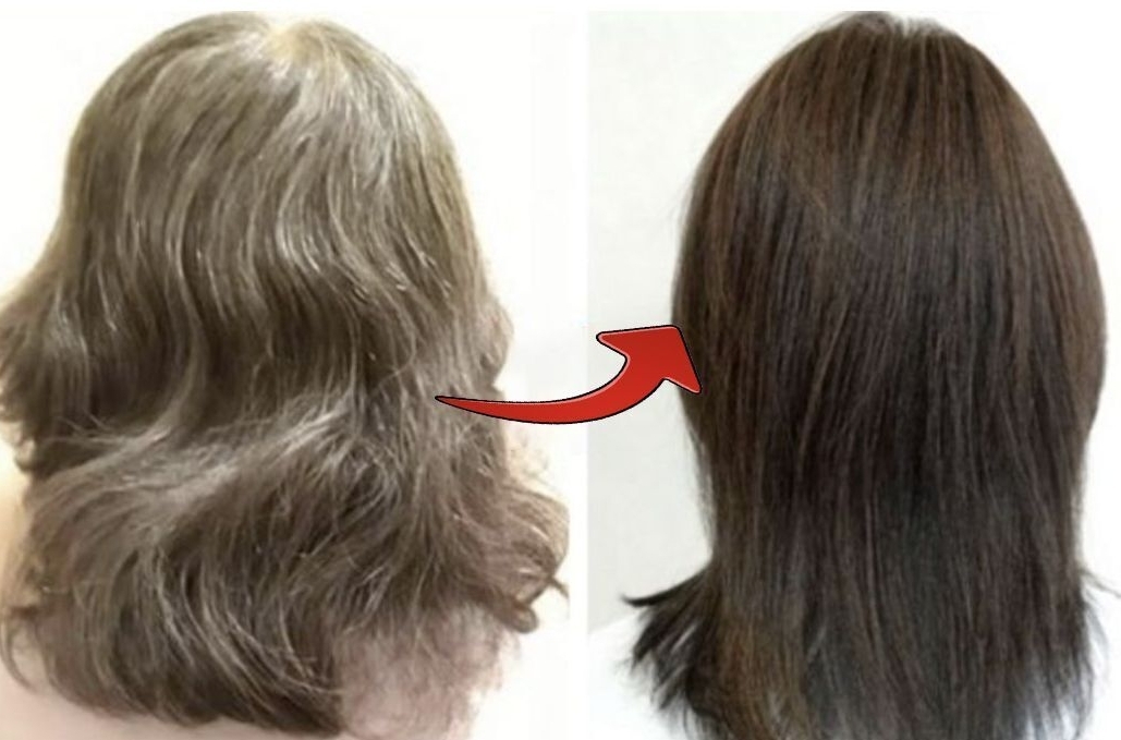 ビフォーアフター