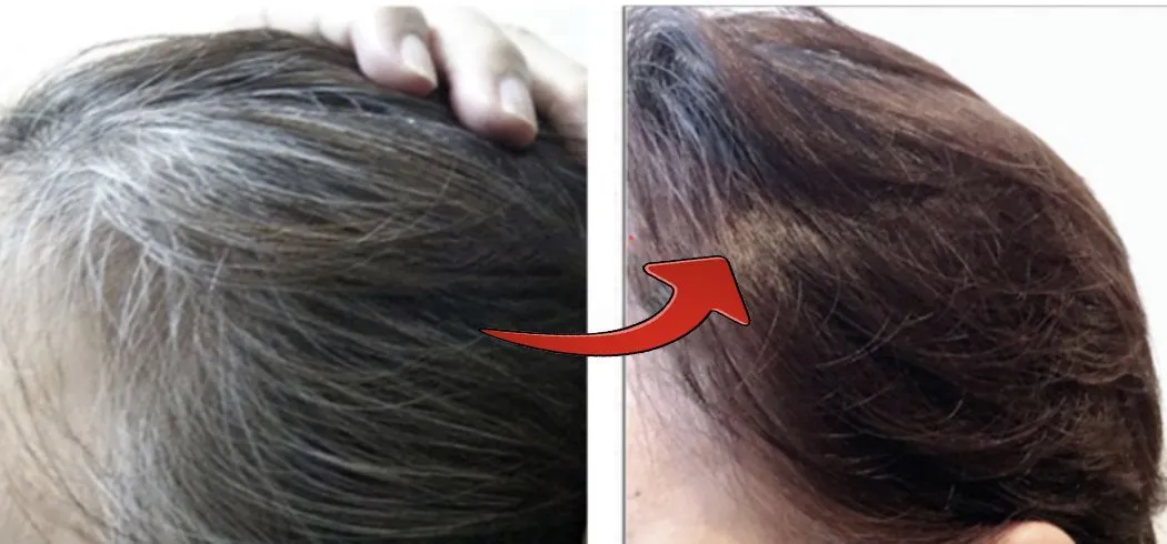 ビフォーアフター